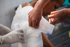 Injured due to severe burns? Call our Memphis Catastrophic Injury Attorneys Now for Help.